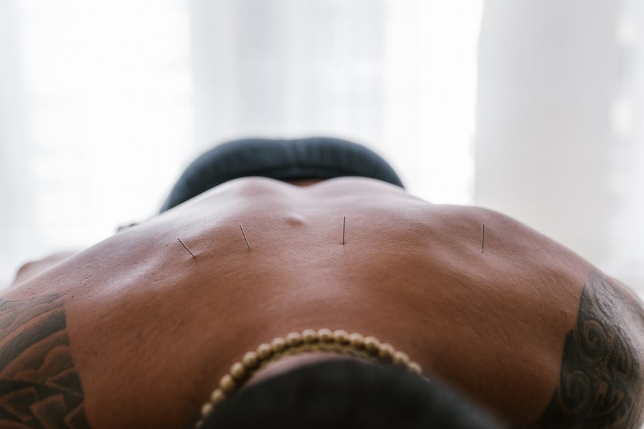 Acupuncture Treatment procedure - Patient consultation at KAHF-accredited hospital in Seoul, South Korea