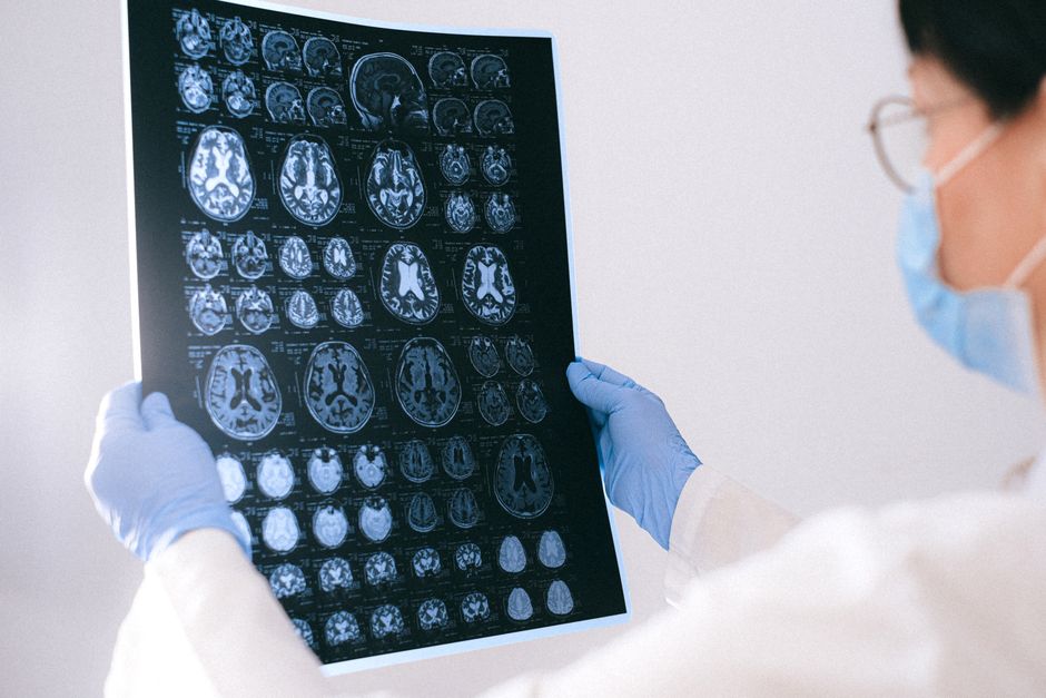 Neurosurgeon reviewing a brain MRI with a patient before brain tumor surgery in Korea