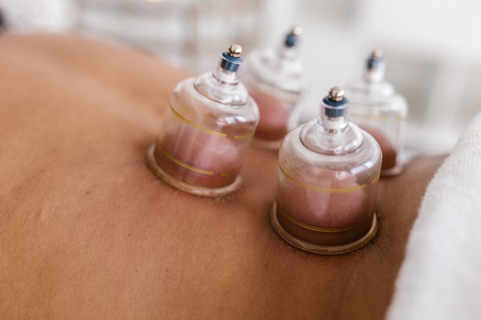 Cupping therapy suction cups placed on a patient's back during a buhang session in Korea