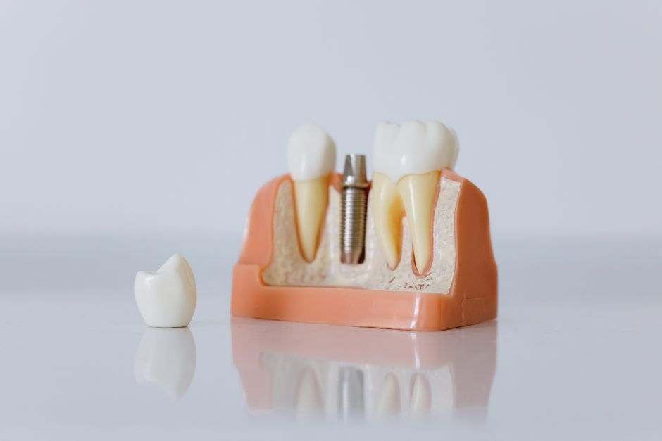 Dental surgeon reviewing a 3D CBCT scan with a patient at a modern Seoul dental clinic