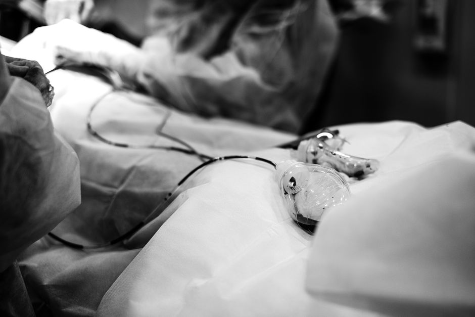 Surgical team performing heart transplant with cardiopulmonary bypass in Korean hospital