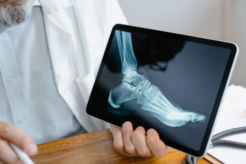 Orthopedic surgeon reviewing knee X-ray before replacement in Korea