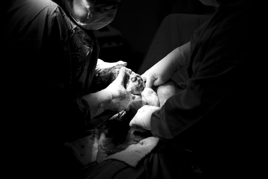 Surgical team performing neonatal open-heart repair using cardiopulmonary bypass in a Korean cardiac center