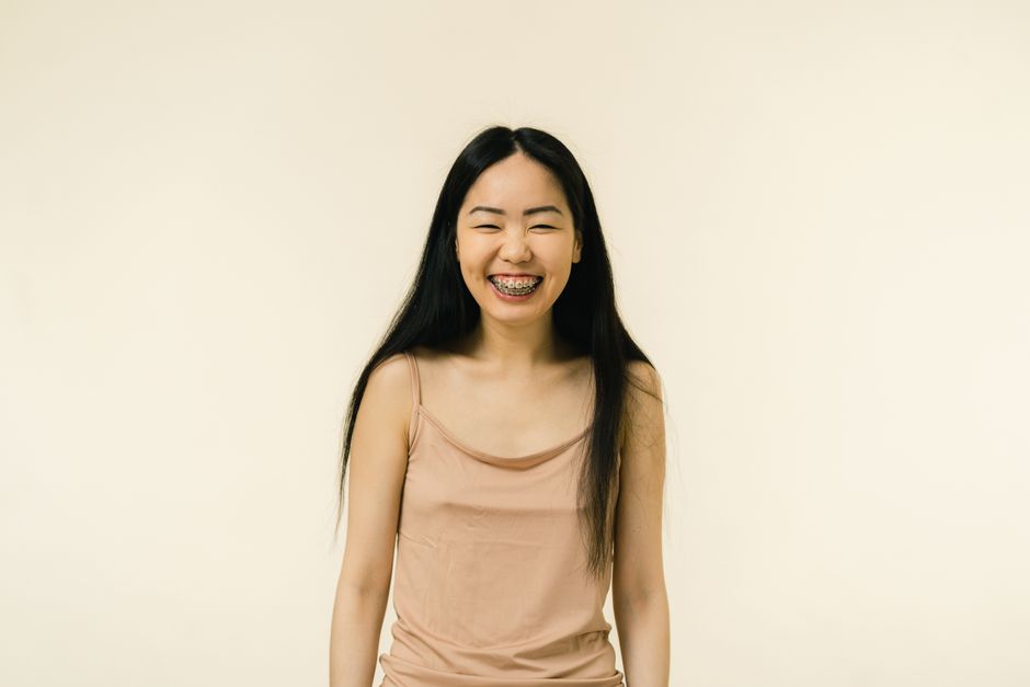 Patient smile showing aligned teeth after completing orthodontic treatment in Korea