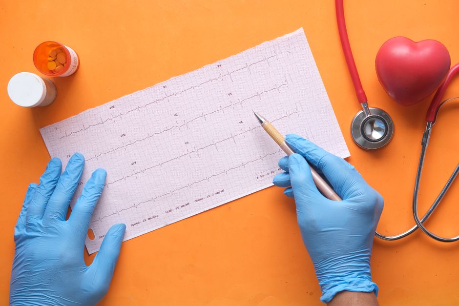 Cardiac catheterisation lab during percutaneous coronary intervention coronary stent placement procedure