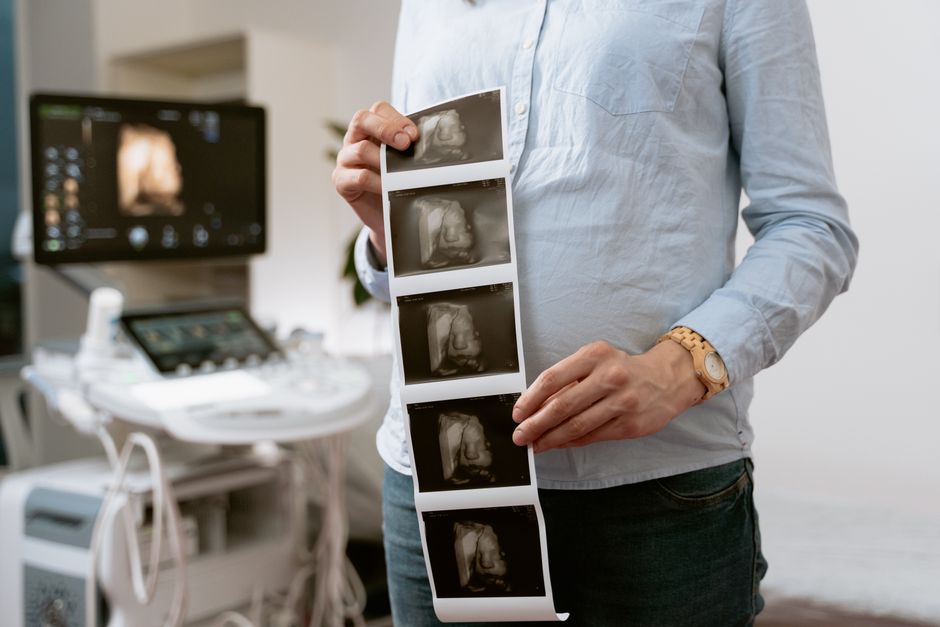 Obstetric ultrasound scan during a prenatal care package visit in Korea