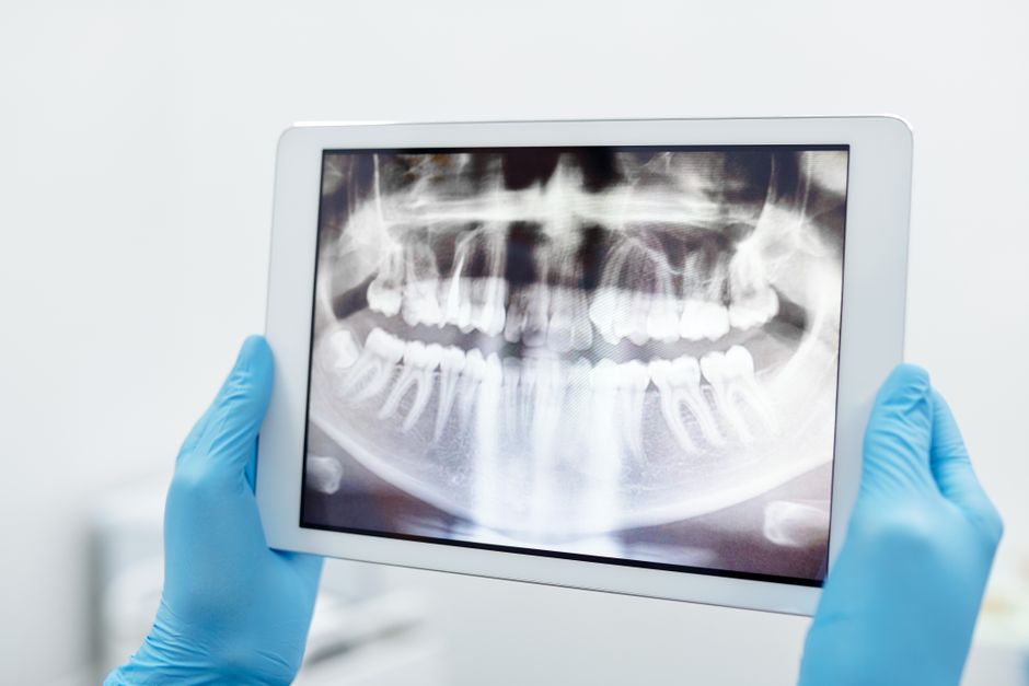 Prosthodontist reviewing digital scan with patient at a modern Seoul dental clinic