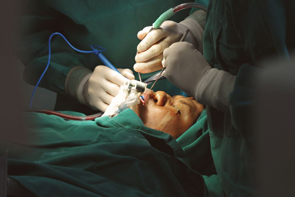 Rhinoplasty surgery at a Korean plastic surgery clinic