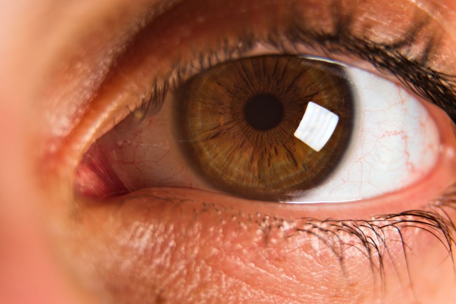 SMILE minimally invasive laser vision correction in Korea