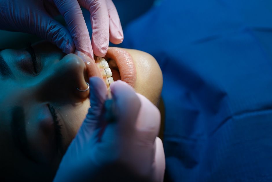 Orthodontic Treatment procedure - Patient consultation at KAHF-accredited hospital in Seoul, South Korea
