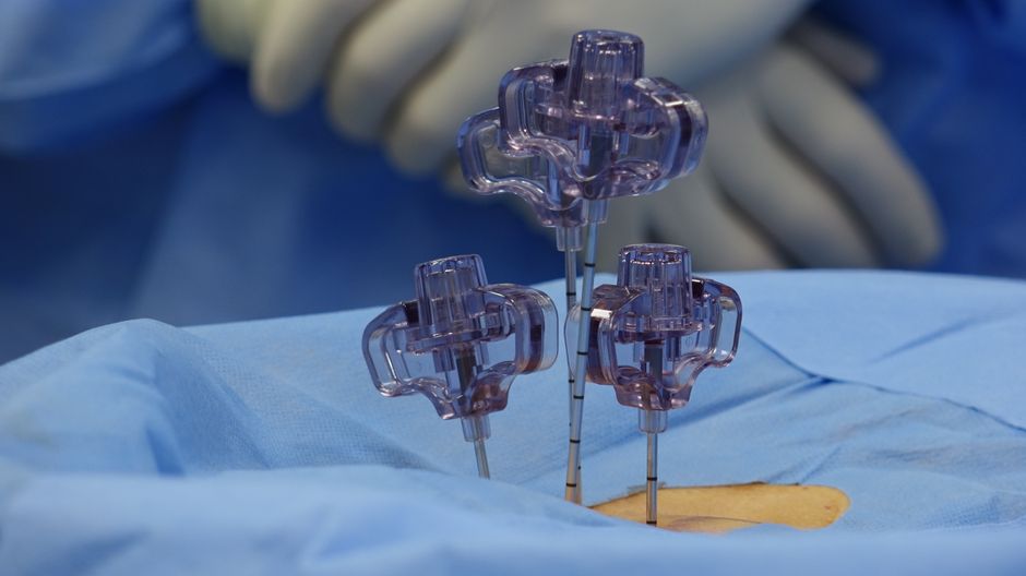 Transforaminal Endoscopic Lumbar Discectomy procedure - Patient consultation at KAHF-accredited hospital in Seoul, South Korea